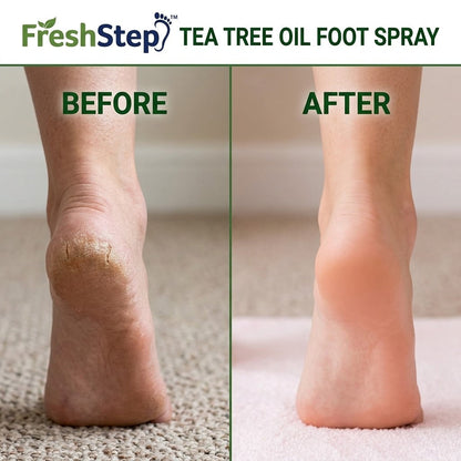 FreshStep™ Tea Tree Oil Foot Spray